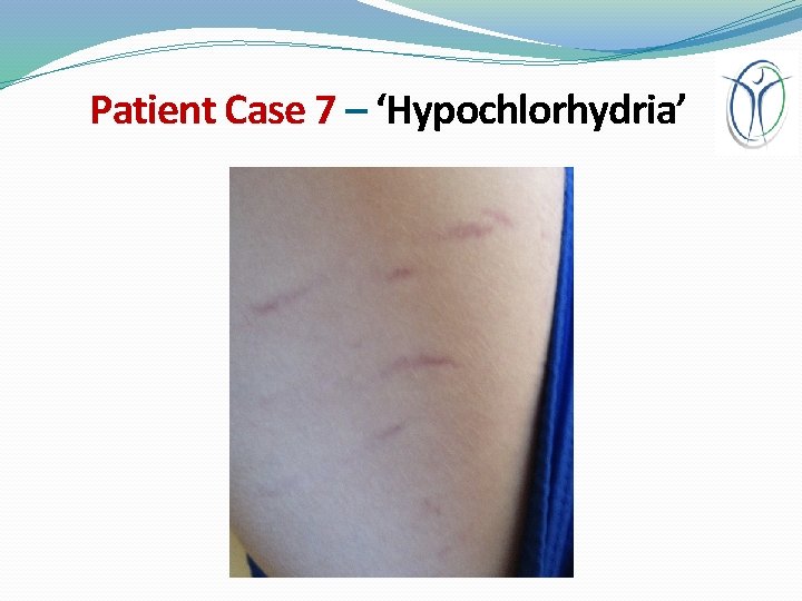 Patient Case 7 – ‘Hypochlorhydria’ 