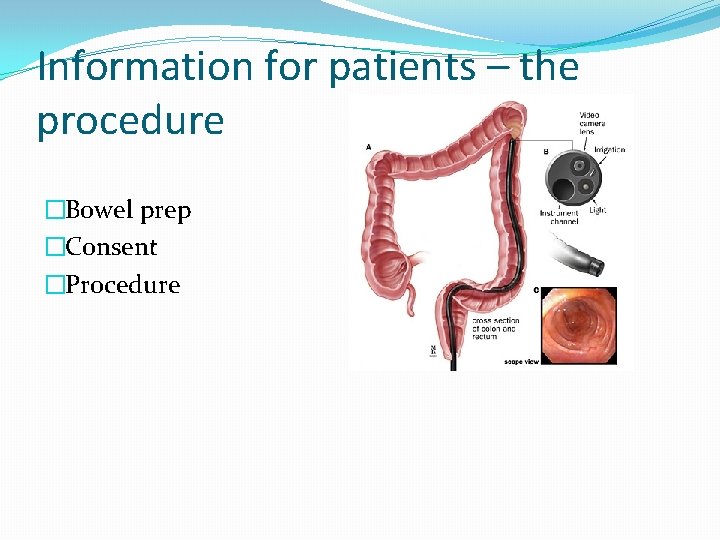 Information for patients – the procedure �Bowel prep �Consent �Procedure 