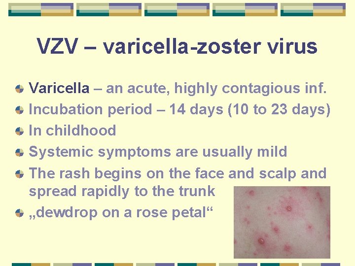 VZV – varicella-zoster virus Varicella – an acute, highly contagious inf. Incubation period –