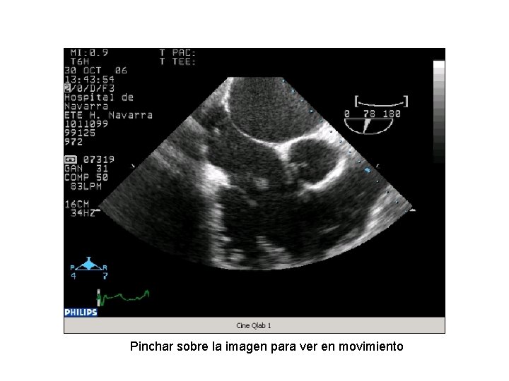 Pinchar sobre la imagen para ver en movimiento 