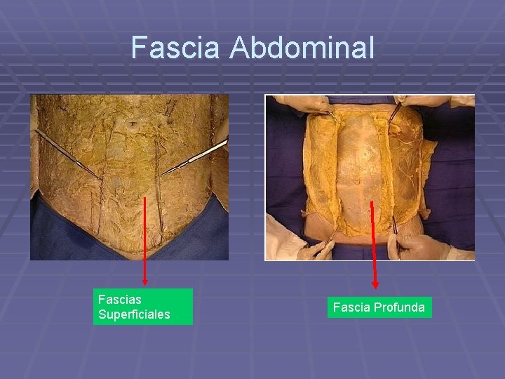 Fascia Abdominal Fascias Superficiales Fascia Profunda 