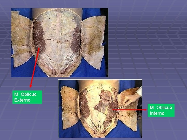 M. Oblicuo Externo M. Oblicuo Interno 