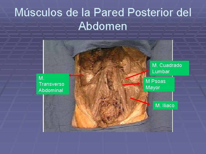 Músculos de la Pared Posterior del Abdomen M. Cuadrado Lumbar M. Transverso Abdominal M