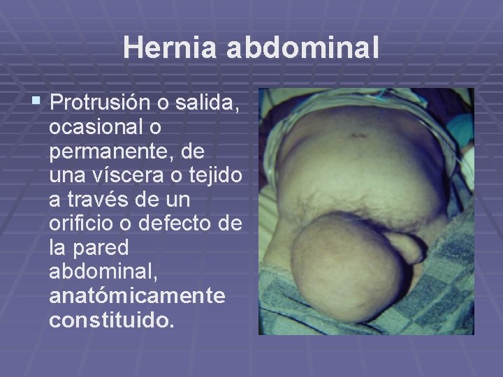 Hernia abdominal § Protrusión o salida, ocasional o permanente, de una víscera o tejido