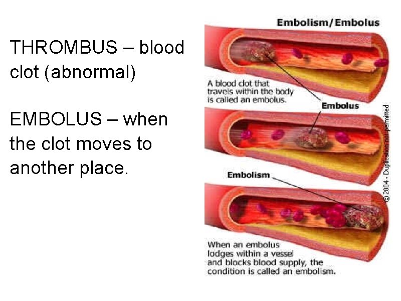 THROMBUS – blood clot (abnormal) EMBOLUS – when the clot moves to another place.