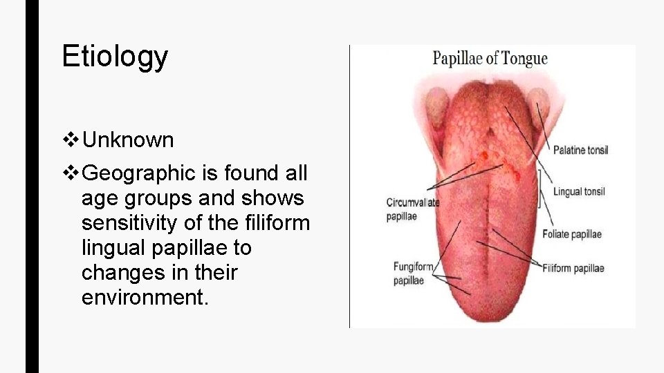 Etiology v Unknown v Geographic is found all age groups and shows sensitivity of