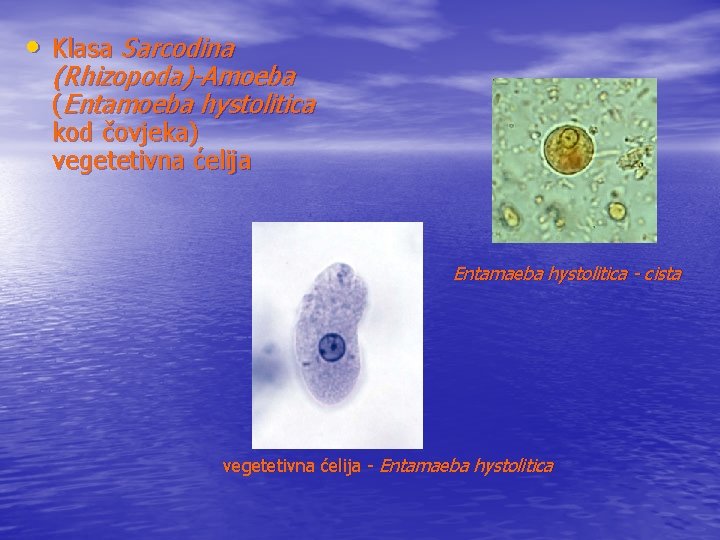  • Klasa Sarcodina (Rhizopoda)-Amoeba (Entamoeba hystolitica kod čovjeka) vegetetivna ćelija Entamaeba hystolitica -