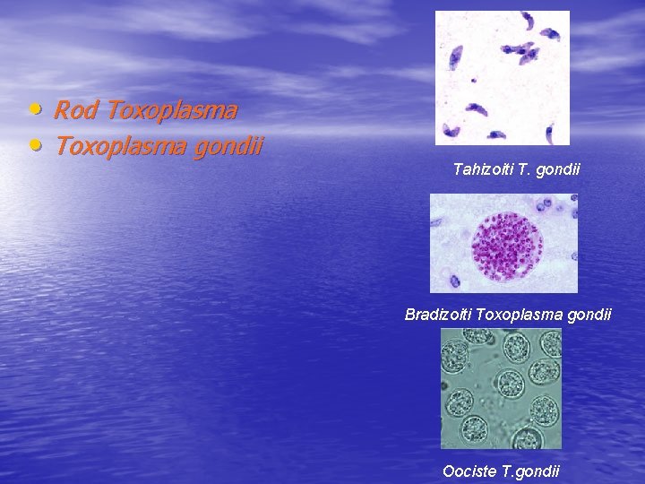  • Rod Toxoplasma • Toxoplasma gondii Tahizoiti T. gondii Bradizoiti Toxoplasma gondii Oociste