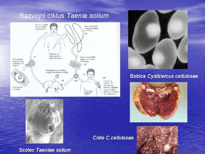 Razvojni ciklus Taenia solium Bobice Cysticercus cellulosae Ciste C. cellulosae Scolex Taeniae solium 