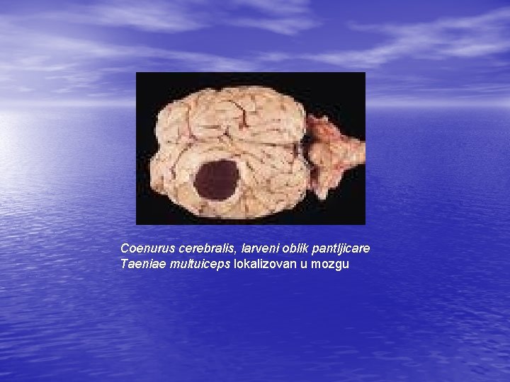 Coenurus cerebralis, larveni oblik pantljicare Taeniae multuiceps lokalizovan u mozgu 