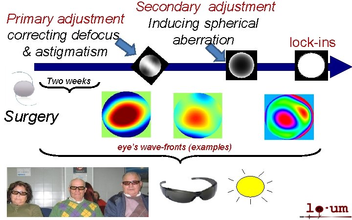 Secondary adjustment Primary adjustment Inducing spherical correcting defocus aberration & astigmatism Two weeks Surgery
