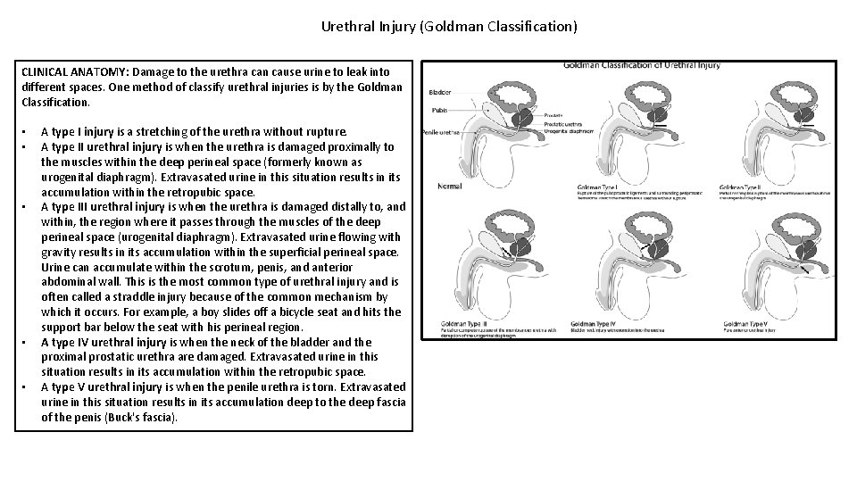 Urethral Injury (Goldman Classification) CLINICAL ANATOMY: Damage to the urethra can cause urine to