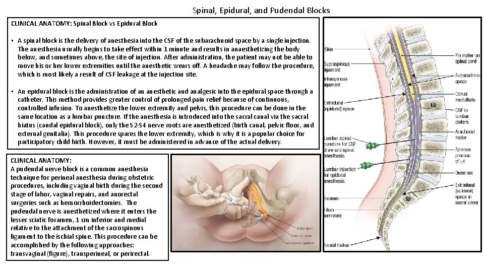 Spinal, Epidural, and Pudendal Blocks CLINICAL ANATOMY: Spinal Block vs Epidural Block • A