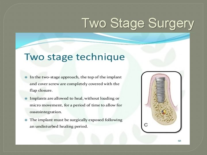 Two Stage Surgery 