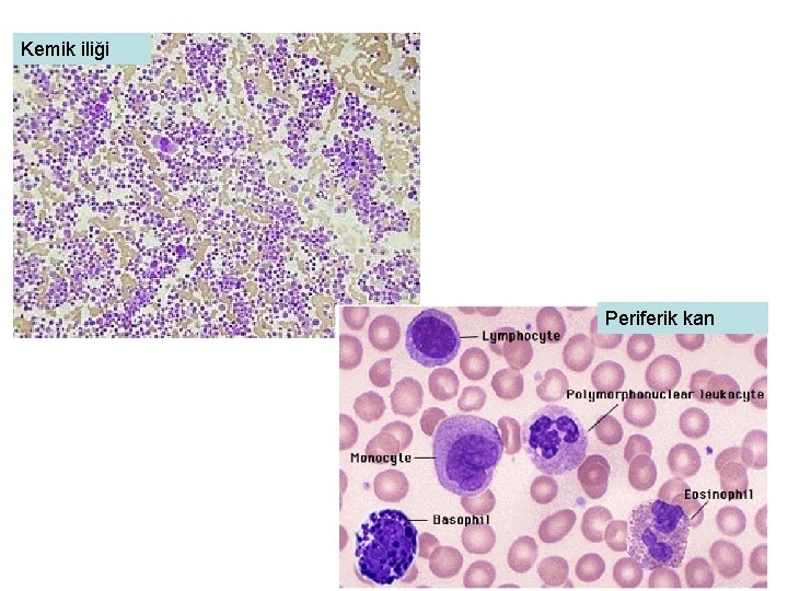 Kemik iliği Periferik kan 11 