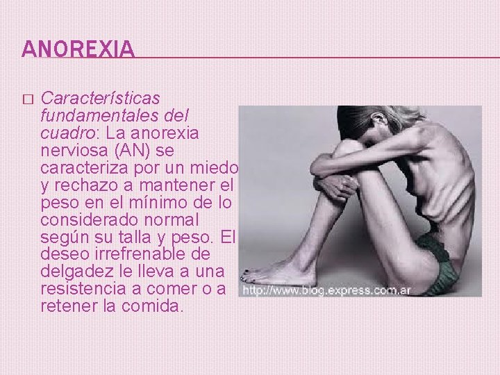 ANOREXIA � Características fundamentales del cuadro: La anorexia nerviosa (AN) se caracteriza por un