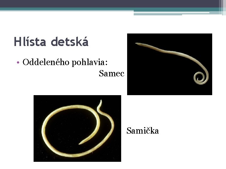 Hlísta detská • Oddeleného pohlavia: Samec Samička 