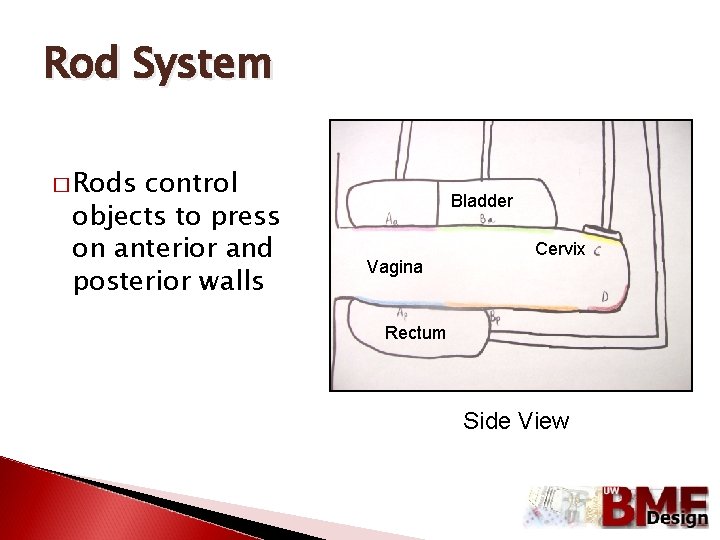 Rod System � Rods control objects to press on anterior and posterior walls Bladder