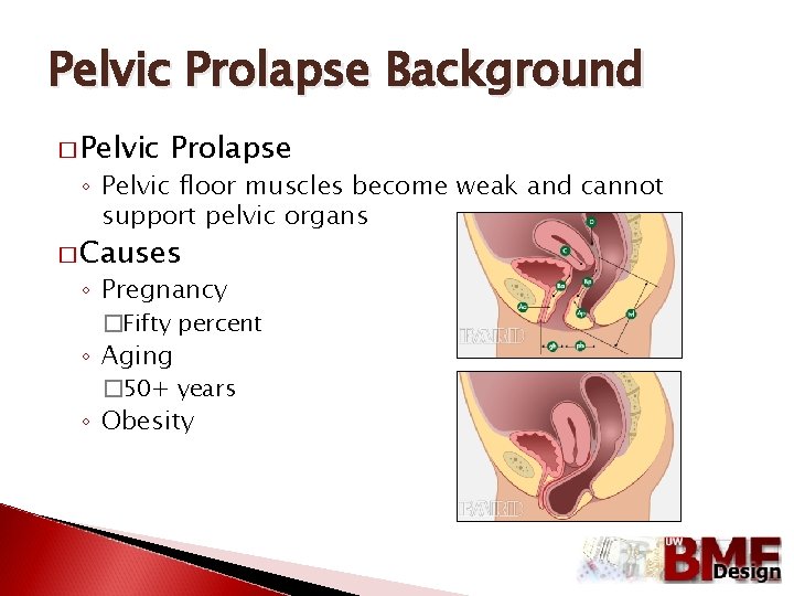 Pelvic Prolapse Background � Pelvic Prolapse ◦ Pelvic floor muscles become weak and cannot