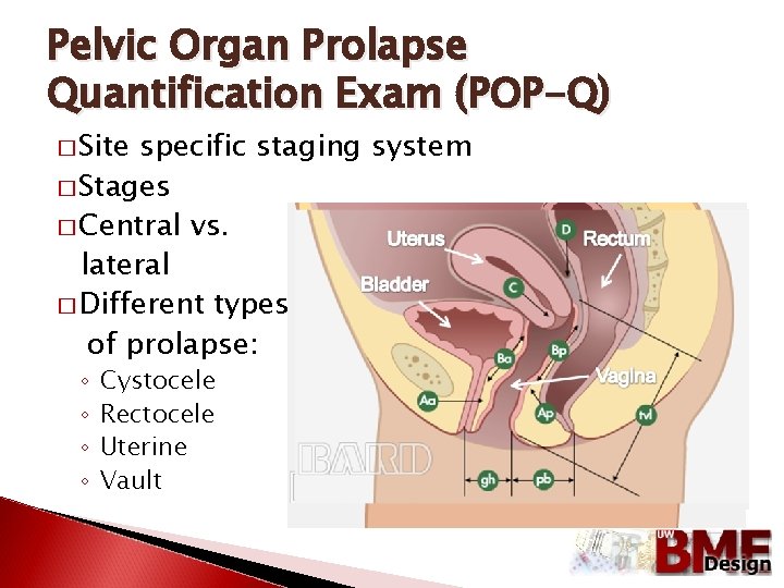 Pelvic Organ Prolapse Quantification Exam (POP-Q) � Site specific staging system � Stages �