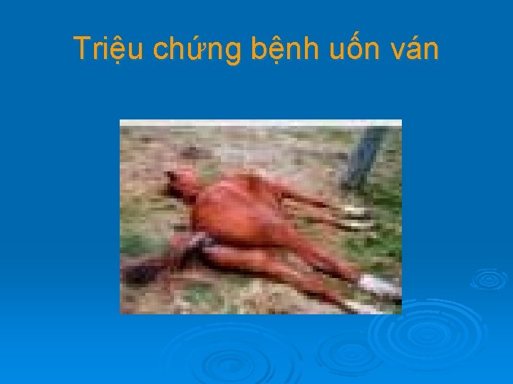 Triệu chứng bệnh uốn ván 