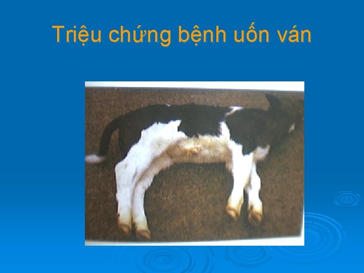 Triệu chứng bệnh uốn ván 