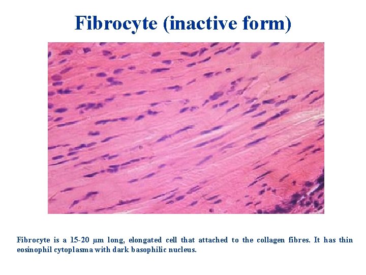 Fibrocyte (inactive form) Fibrocyte is a 15 -20 µm long, elongated cell that attached Fibrocyte (inactive form) Fibrocyte is a 15 -20 µm long, elongated cell that attached