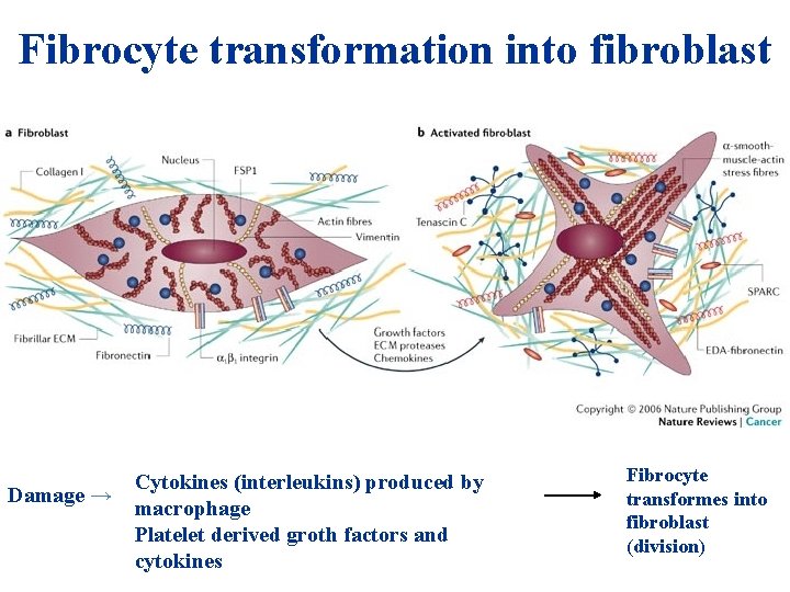 Fibrocyte transformation into fibroblast Damage → Cytokines (interleukins) produced by macrophage Platelet derived groth Fibrocyte transformation into fibroblast Damage → Cytokines (interleukins) produced by macrophage Platelet derived groth