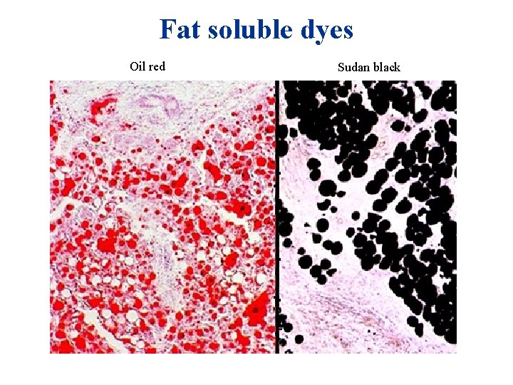 Fat soluble dyes Oil red Sudan black Fat soluble dyes Oil red Sudan black