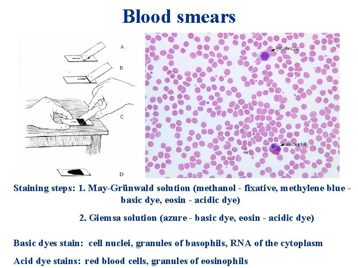 Blood smears Staining steps: 1. May-Grünwald solution (methanol - fixative, methylene blue basic dye, Blood smears Staining steps: 1. May-Grünwald solution (methanol - fixative, methylene blue basic dye,