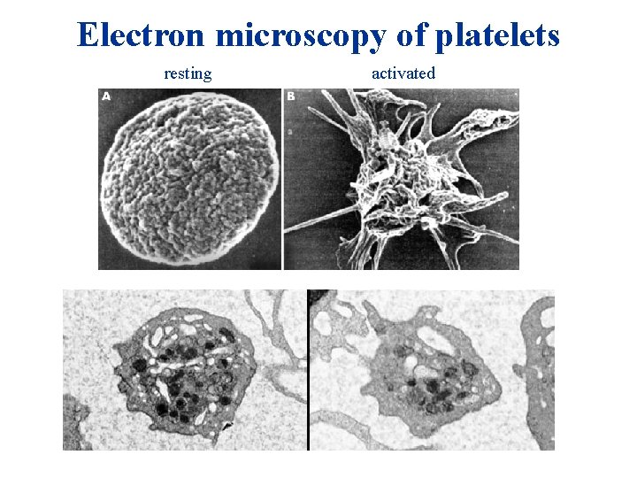 Electron microscopy of platelets resting activated Electron microscopy of platelets resting activated