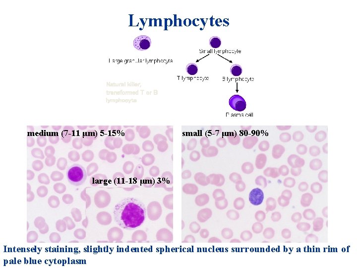 Lymphocytes Natural killer, transformed T or B lymphocyte medium (7 -11 μm) 5 -15% Lymphocytes Natural killer, transformed T or B lymphocyte medium (7 -11 μm) 5 -15%