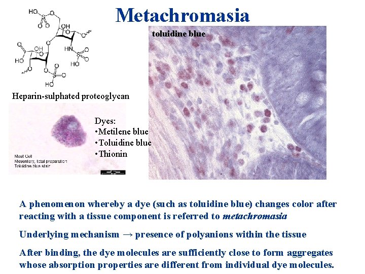 Metachromasia toluidine blue Heparin-sulphated proteoglycan Dyes: • Metilene blue • Toluidine blue • Thionin Metachromasia toluidine blue Heparin-sulphated proteoglycan Dyes: • Metilene blue • Toluidine blue • Thionin