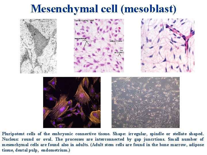 Mesenchymal cell (mesoblast) Pluripotent cells of the embryonic connective tissue. Shape: irregular, spindle or Mesenchymal cell (mesoblast) Pluripotent cells of the embryonic connective tissue. Shape: irregular, spindle or