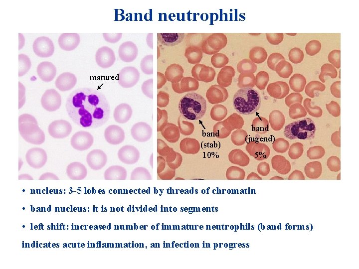 Band neutrophils matured band (stab) 10% band (jugend) 5% • nucleus: 3 -5 lobes Band neutrophils matured band (stab) 10% band (jugend) 5% • nucleus: 3 -5 lobes