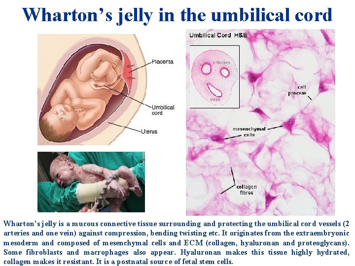 Wharton’s jelly in the umbilical cord Wharton’s jelly is a mucous connective tissue surrounding Wharton’s jelly in the umbilical cord Wharton’s jelly is a mucous connective tissue surrounding