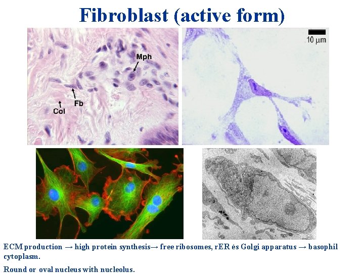 Fibroblast (active form) ECM production → high protein synthesis→ free ribosomes, r. ER és Fibroblast (active form) ECM production → high protein synthesis→ free ribosomes, r. ER és
