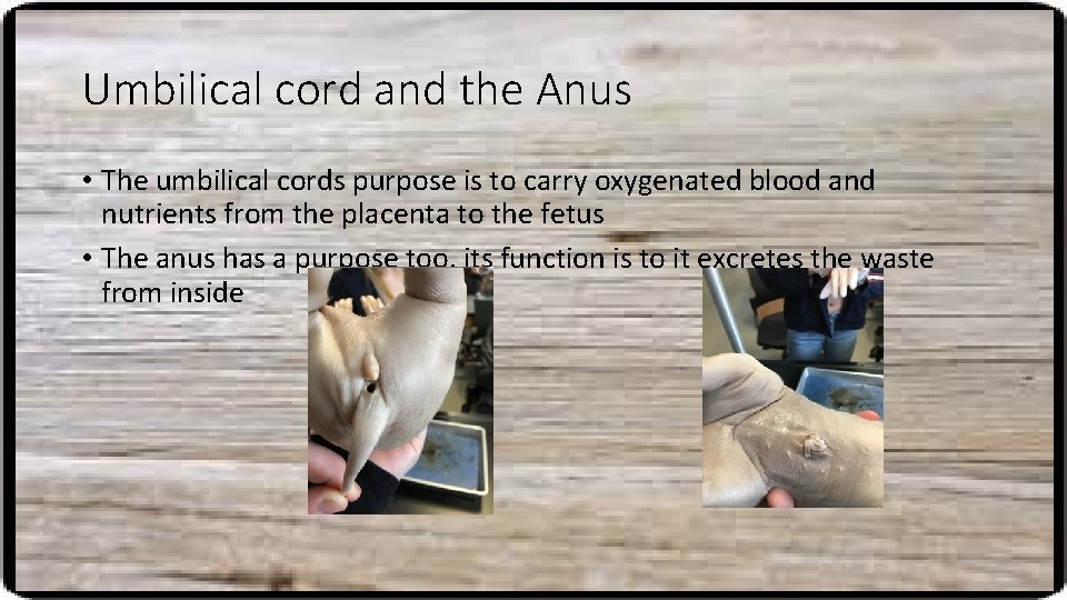 Umbilical cord and the Anus • The umbilical cords purpose is to carry oxygenated