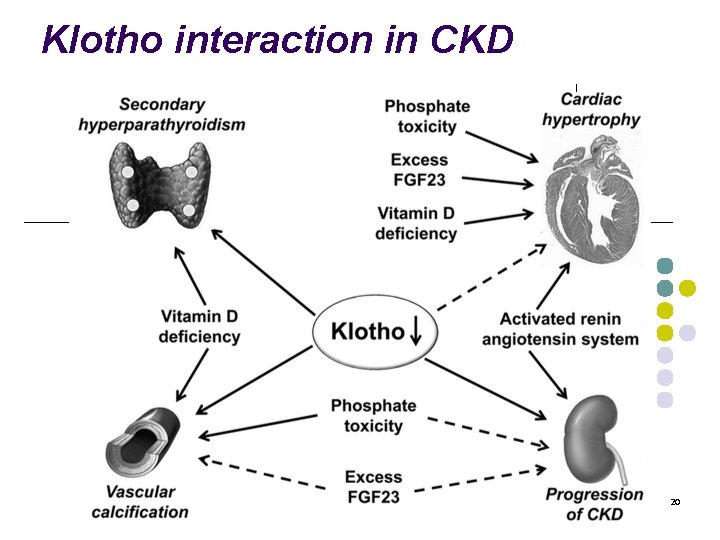 Klotho interaction in CKD 20 