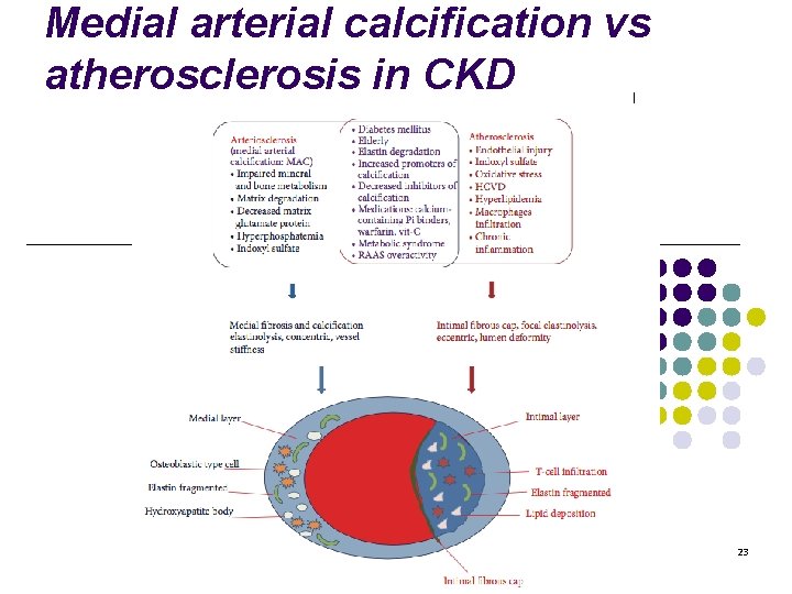 Medial arterial calcification vs atherosclerosis in CKD 23 