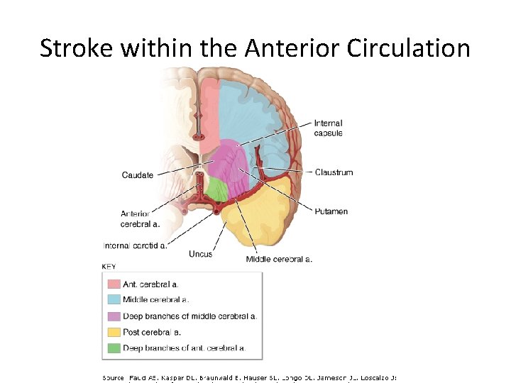 Stroke within the Anterior Circulation 