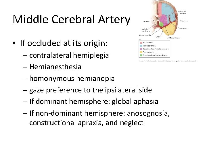 Middle Cerebral Artery • If occluded at its origin: – contralateral hemiplegia – Hemianesthesia