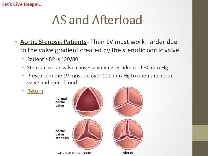 Let’s Dive Deeper… AS and Afterload • Aortic Stenosis Patients- Their LV must work