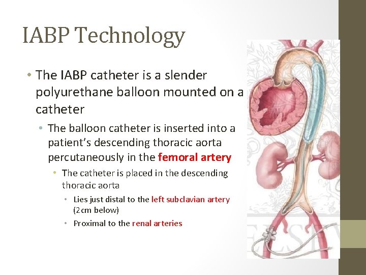 IABP Technology • The IABP catheter is a slender polyurethane balloon mounted on a