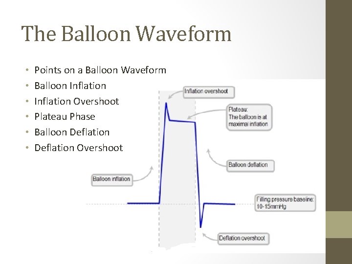 The Balloon Waveform • • • Points on a Balloon Waveform Balloon Inflation Overshoot