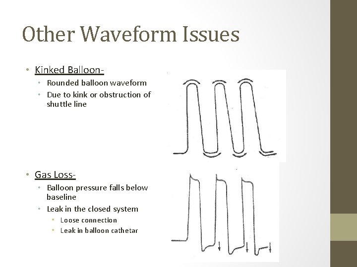 Other Waveform Issues • Kinked Balloon • Rounded balloon waveform • Due to kink