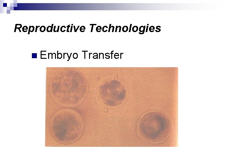 Reproductive Technologies n Embryo Transfer 
