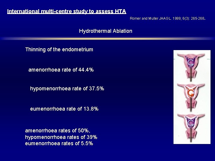 International multi-centre study to assess HTA Romer and Muller JAAGL. 1999; 6(3): 265 -268.