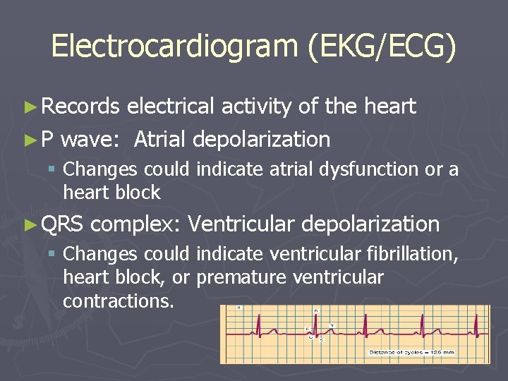 Electrocardiogram (EKG/ECG) ► Records electrical activity of the heart ► P wave: Atrial depolarization