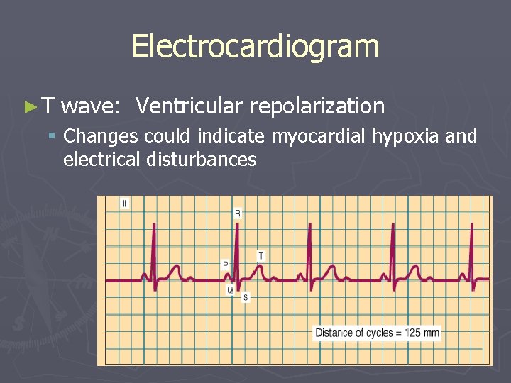 Electrocardiogram ►T wave: Ventricular repolarization § Changes could indicate myocardial hypoxia and electrical disturbances